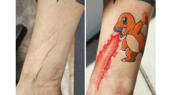 Un fan de Pokémon usa un tatuaje de Charmander para cubrir una cicatriz